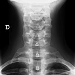 Columna cervical