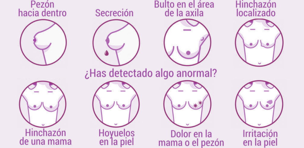 Manifestación del cáncer de mama